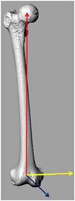 The Presence of Cartilage Affects Femoral Rotational Alignment in Total Knee Arthroplasty